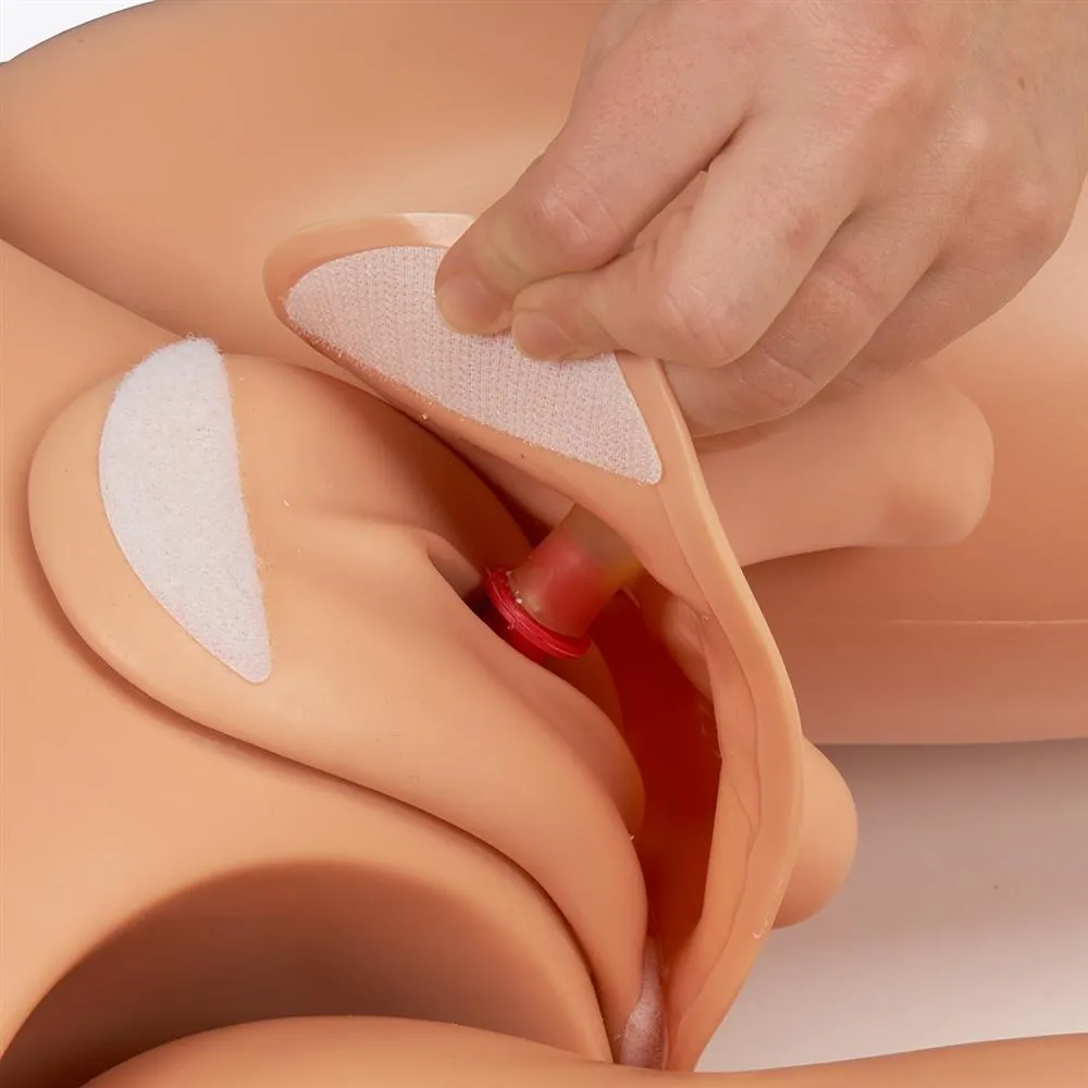 Susie® Simon® Patient Care Simulator with Ostomy, Medium